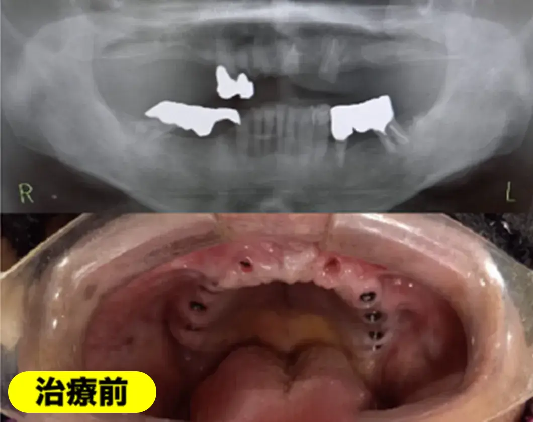 症例