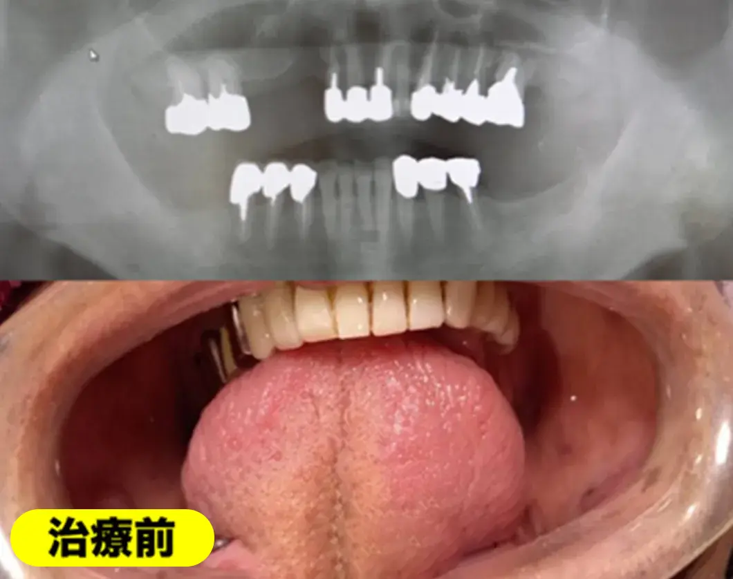 症例