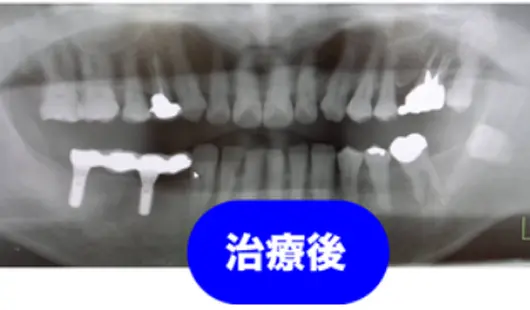 症例
