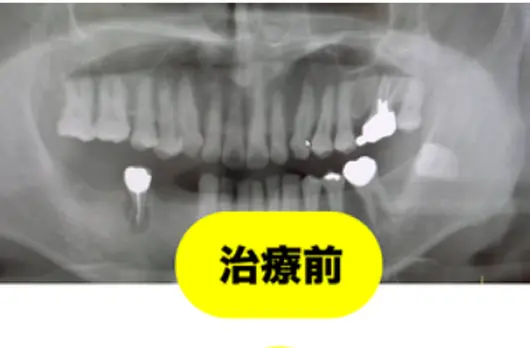 症例
